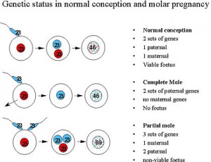 Introduction to Molar Pregnancy – Charing Cross Gestational Trophoblast